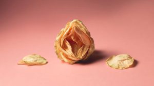 Khô Âm Đạo (vùng kín): Nguyên Nhân, Triệu Chứng Và Cách Chuẩn Đoán